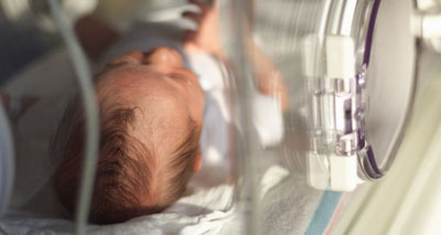 الولادة المبكرة مرتبطة بزيادة المخاطر على الصحة العقلية