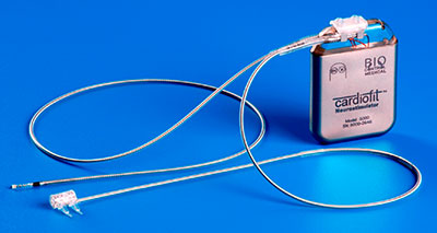 جهاز كهربائي جديد لمعالجة قصور القلب
