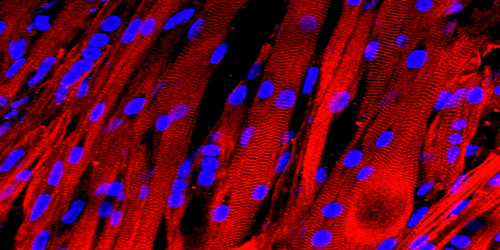 Working Lab-Grown Human Muscles