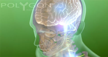 De l'électronique injectée directement dans le cerveau