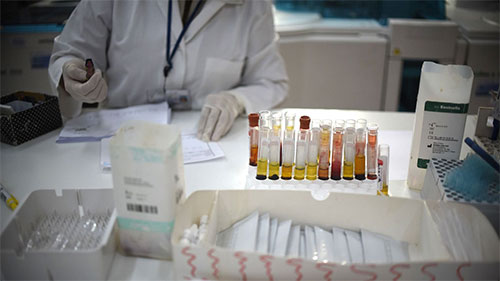علماء يتوقعون انتهاء عدوى فيروس زيكا خلال عامين أو ثلاثة