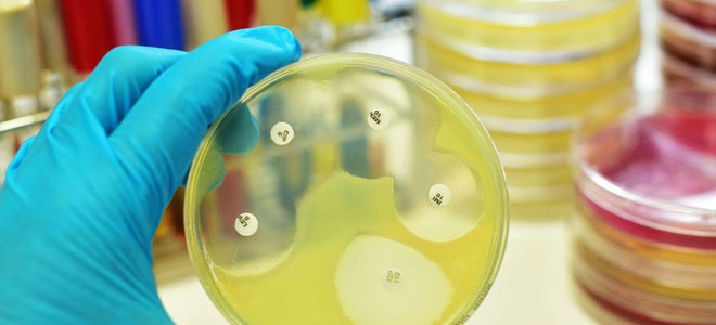 اكتشاف آلية جديدة لمكافحة البكتيريا متعددة المقاومة
