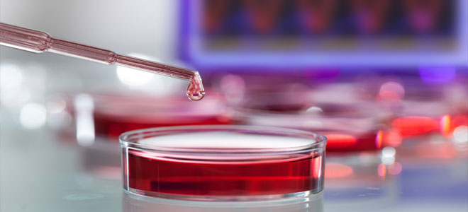 تحليل جديد للدم يعزز آمال اكتشاف السرطان في مراحله المبكرة