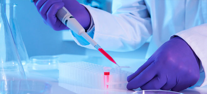 زراعة الخلايا الجذعية تمنح أملاً في علاج تصلّب الجلد